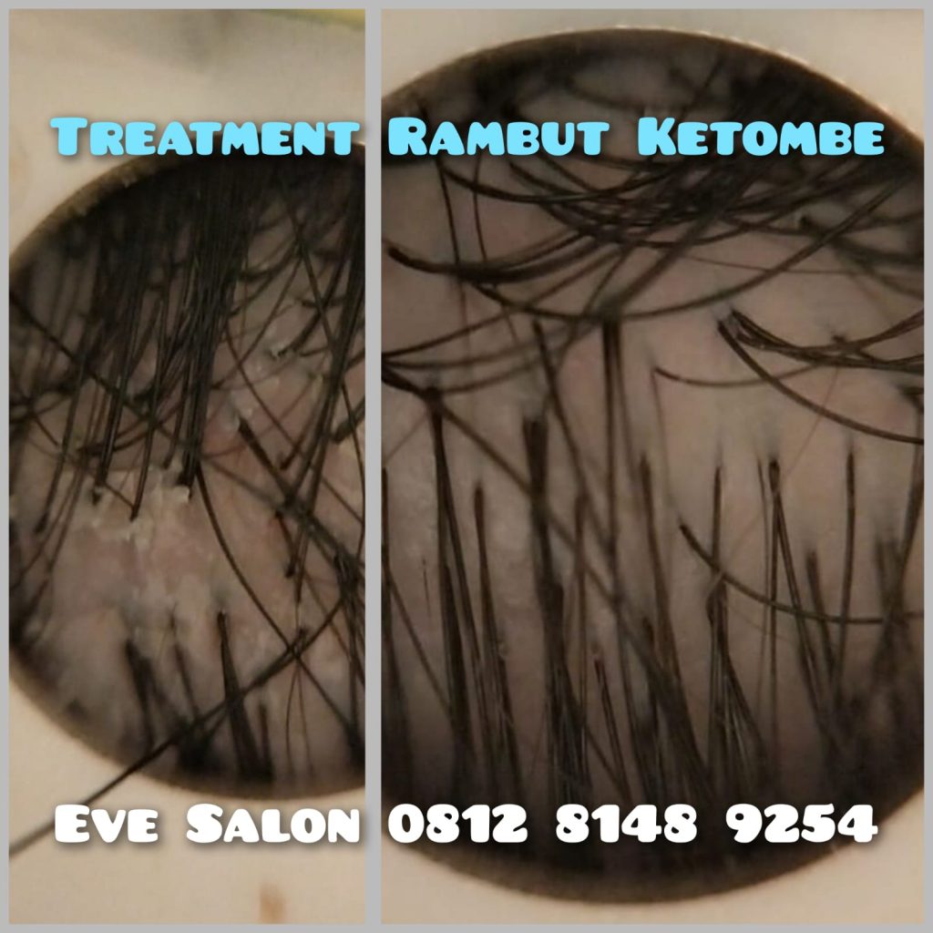 Salon Treatment Ketombe Di GDC Depok