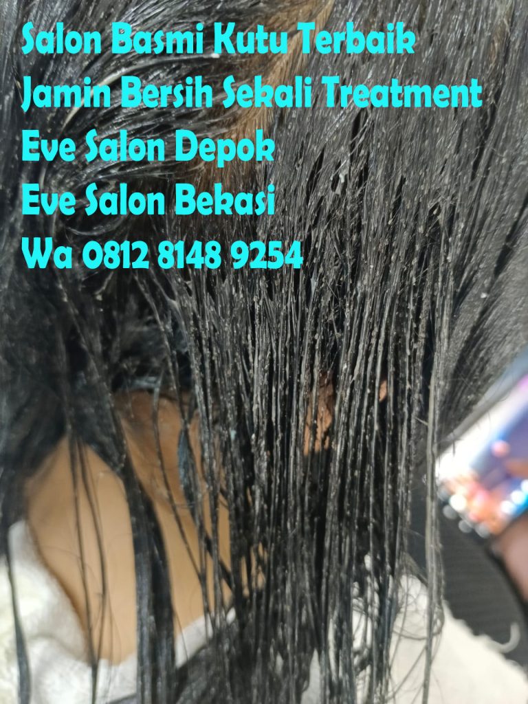 Apakah Ke Salon Bisa Menghilangkan Kutu