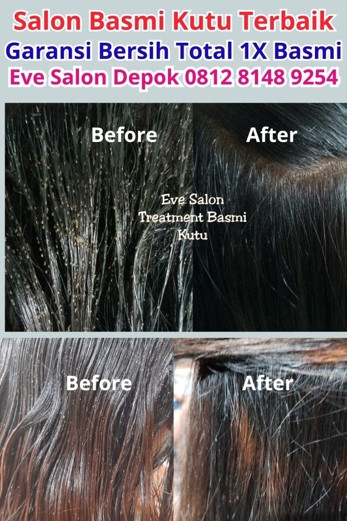 Rekomendasi Salon Kutu Di Jakarta Depok Bekasi