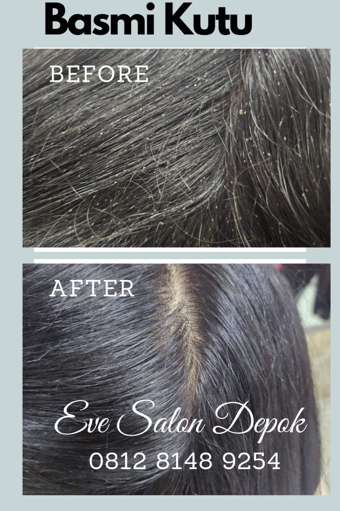 Salon Membersihkan Kutu Di Sentul