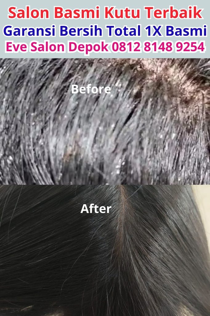 Salon Membersihkan Kutu Di Sentul