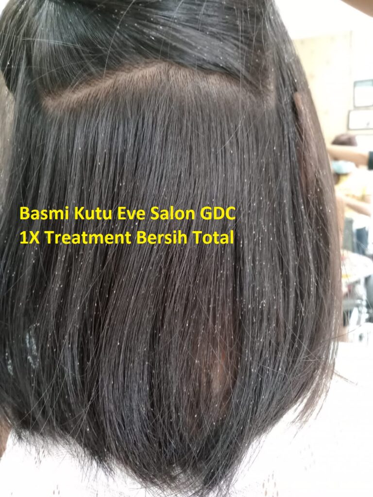 Salon Basmi Kutu Di GDC Depok