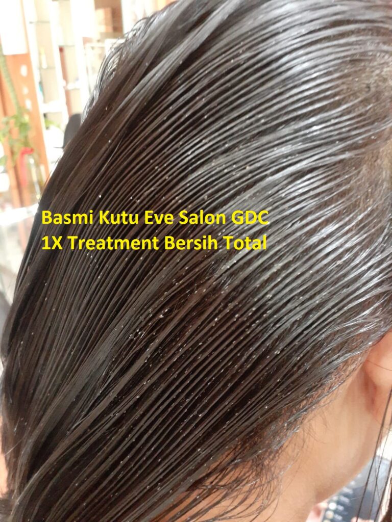 Salon Basmi Kutu Di GDC Depok