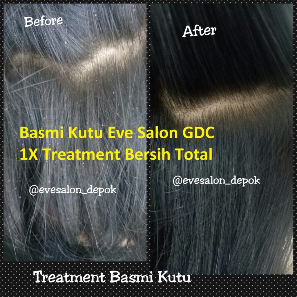 Salon Kutu Sukmajaya Depok