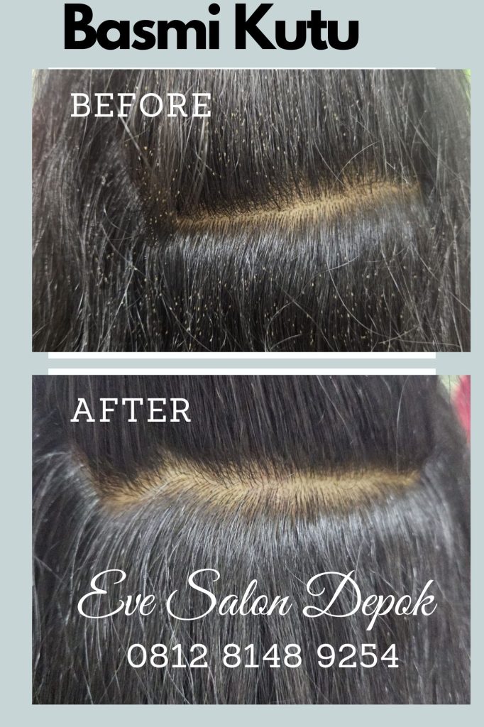Salon Basmi Kutu Tapos Depok