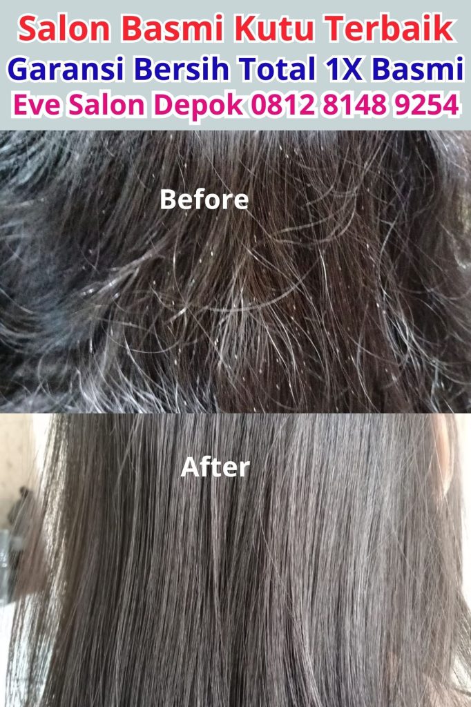 Salon Basmi Kutu di Cibinong: Solusi Ampuh untuk Rambut Sehat dan Bebas Kutu