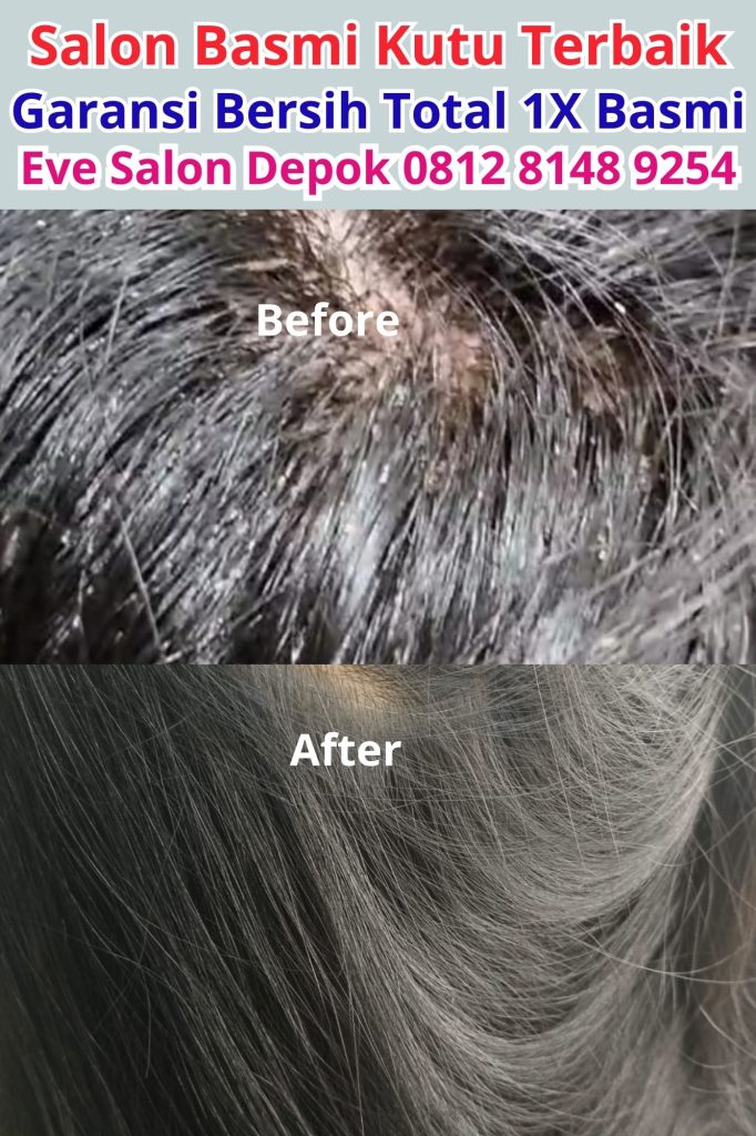 Salon Basmi Kutu di Cibinong: Solusi Ampuh untuk Rambut Sehat dan Bebas Kutu