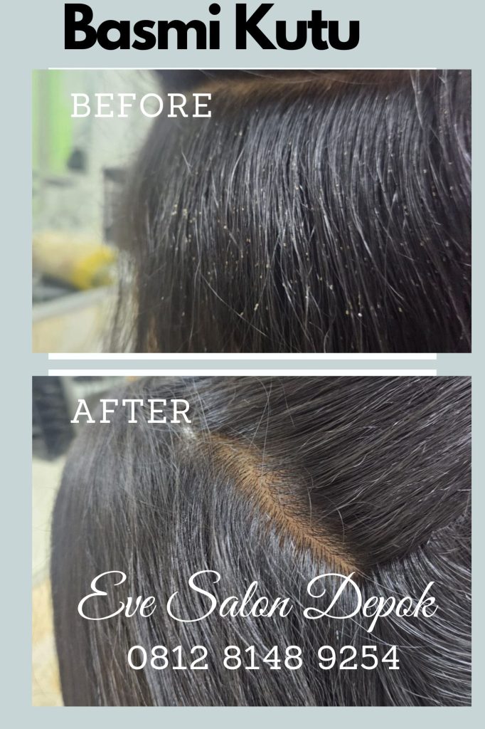 Salon Kutu Cibubur Depok