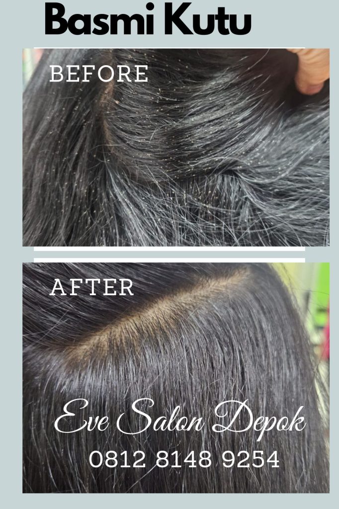 Salon Basmi Kutu Cinere Depok