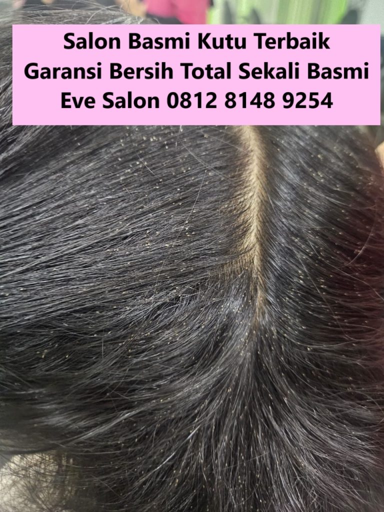 Rekomendasi Salon Kutu Sentul