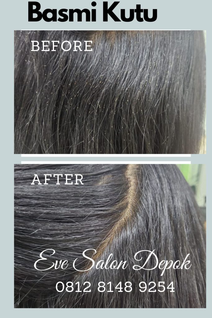 Salon Basmi Kutu Bogor Depok