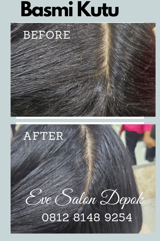 Salon Kutu Bogor