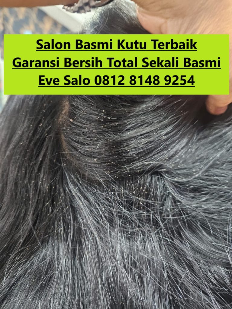 Salon Basmi Kutu Cinere Depok