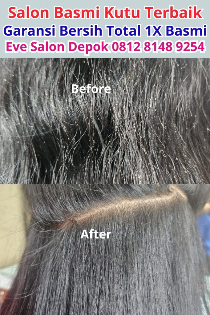 salon menghilangkan kutu rambut cibinong