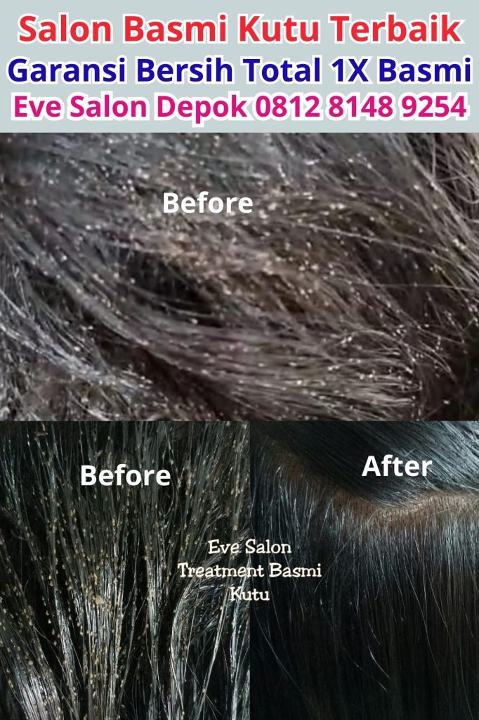 harga menghilankan kutu rambut di salon cibinong