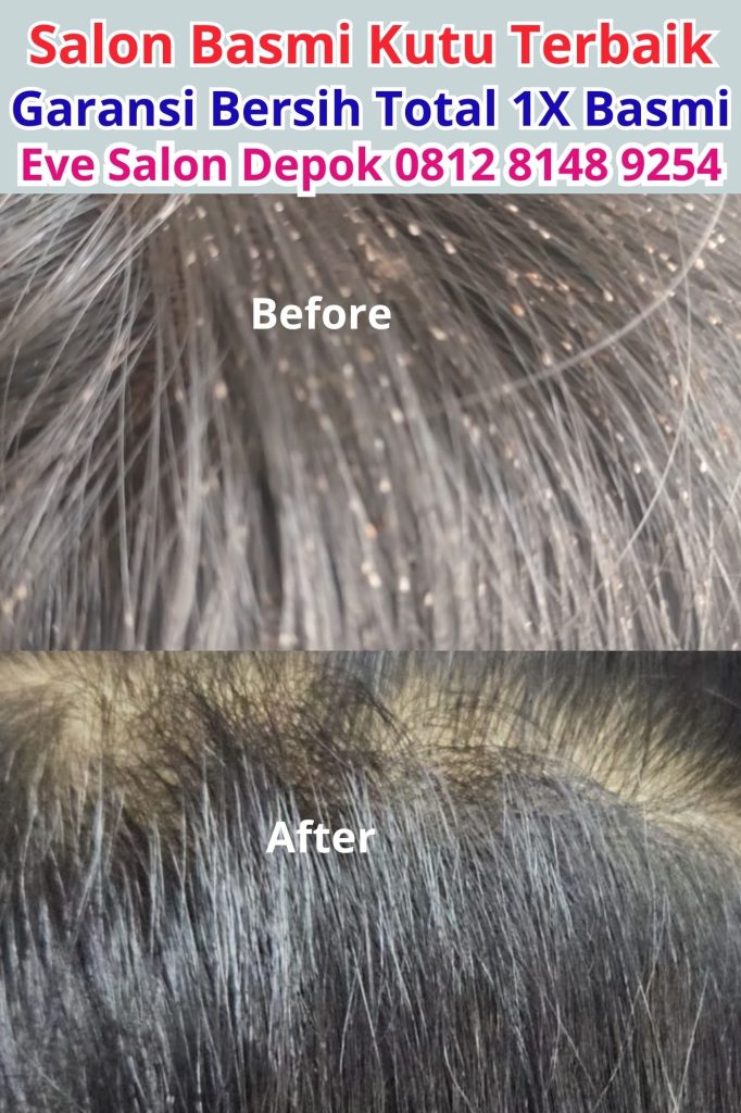 harga salon kutu di cibinong