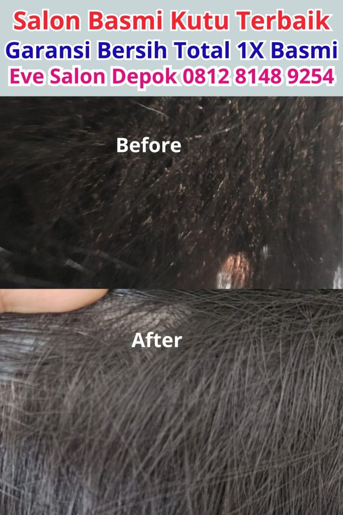 salon ngilangin kutu di cibinong