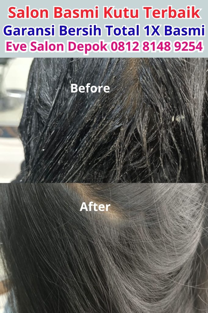 Salon Basmi Kutu Bojong Gede Depok