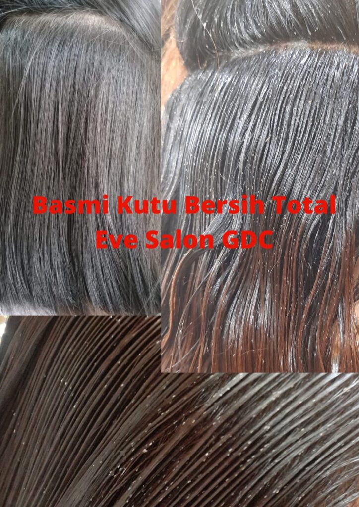 Salon Basmi Kutu Di GDC Depok