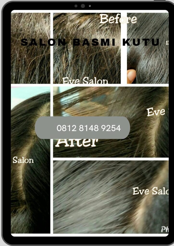 Salon Kutu Anak Bojong Gede Depok