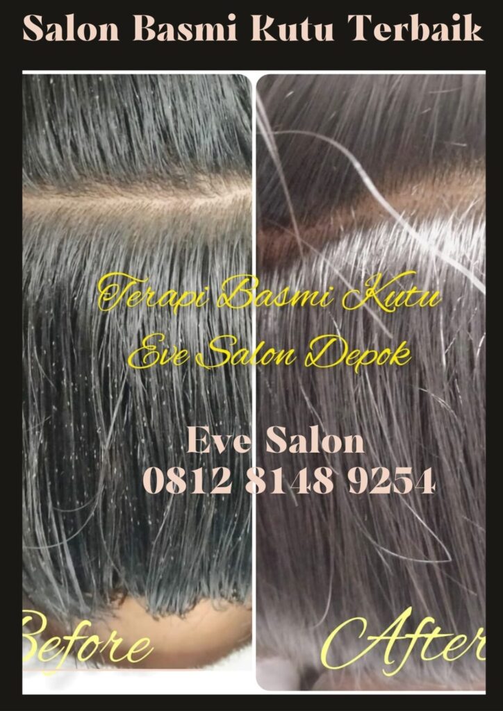 Salon Kutu Citayam Depok