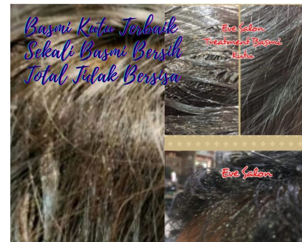 Salon Basmi Kutu Di GDC Depok
