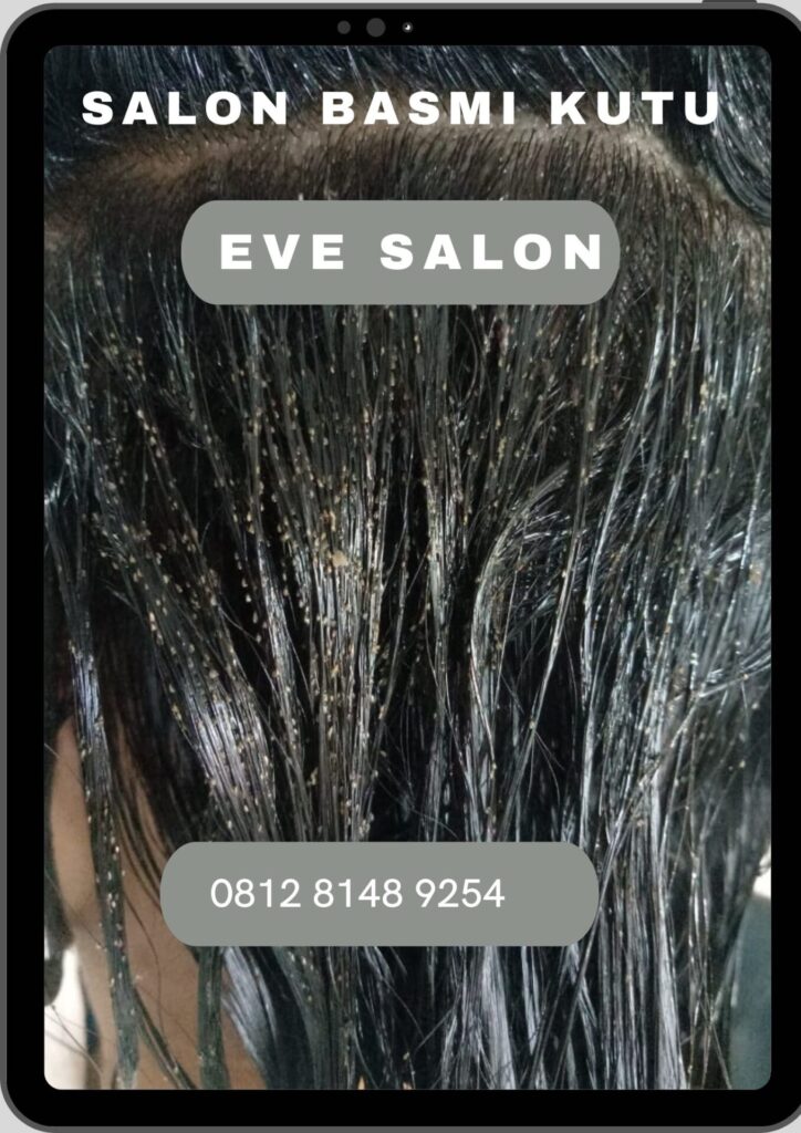 Salon Kutu Anak Bojong Gede Depok