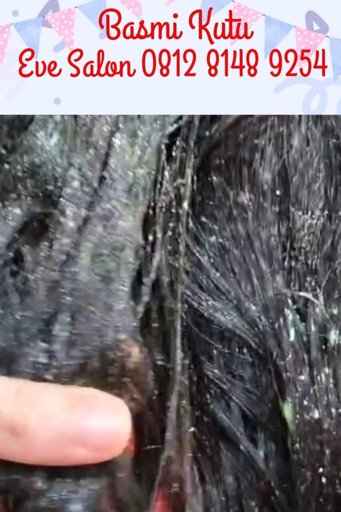 salon penghilang kutu rambut di cibinong