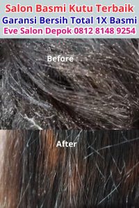 Salon Kutu Di Citetereup
