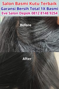 Salon Basmi Kutu Di Cibinong