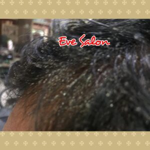 Salon Treatment Ketombe Di GDC Depok