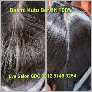 Salon Menghilangkan Kutu Rambut di Bekasi