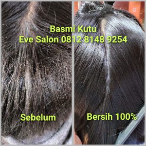 Salon Kutu Bekasi Terbaik