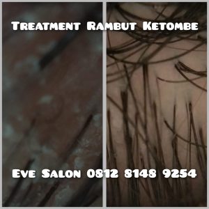 perawatan ketombe di salon GDC Depok