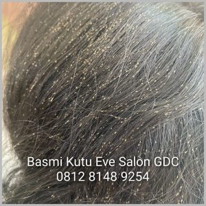 Salon Membersihkan Kutu Rambut Di Margonda Depok Salon Membersihkan Kutu Rambut Di Margonda Depok