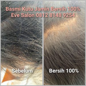Salon Membersihkan Kutu Rambut Di Margonda Depok