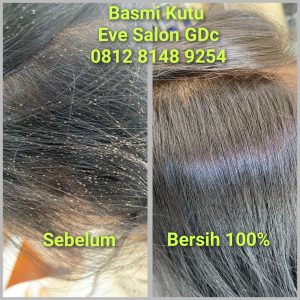 Salon Basmi Kutu Rambut Di Sawangan Depok