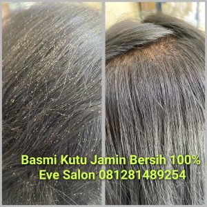 Salon Membersihkan Kutu Rambut Di Margonda Depok