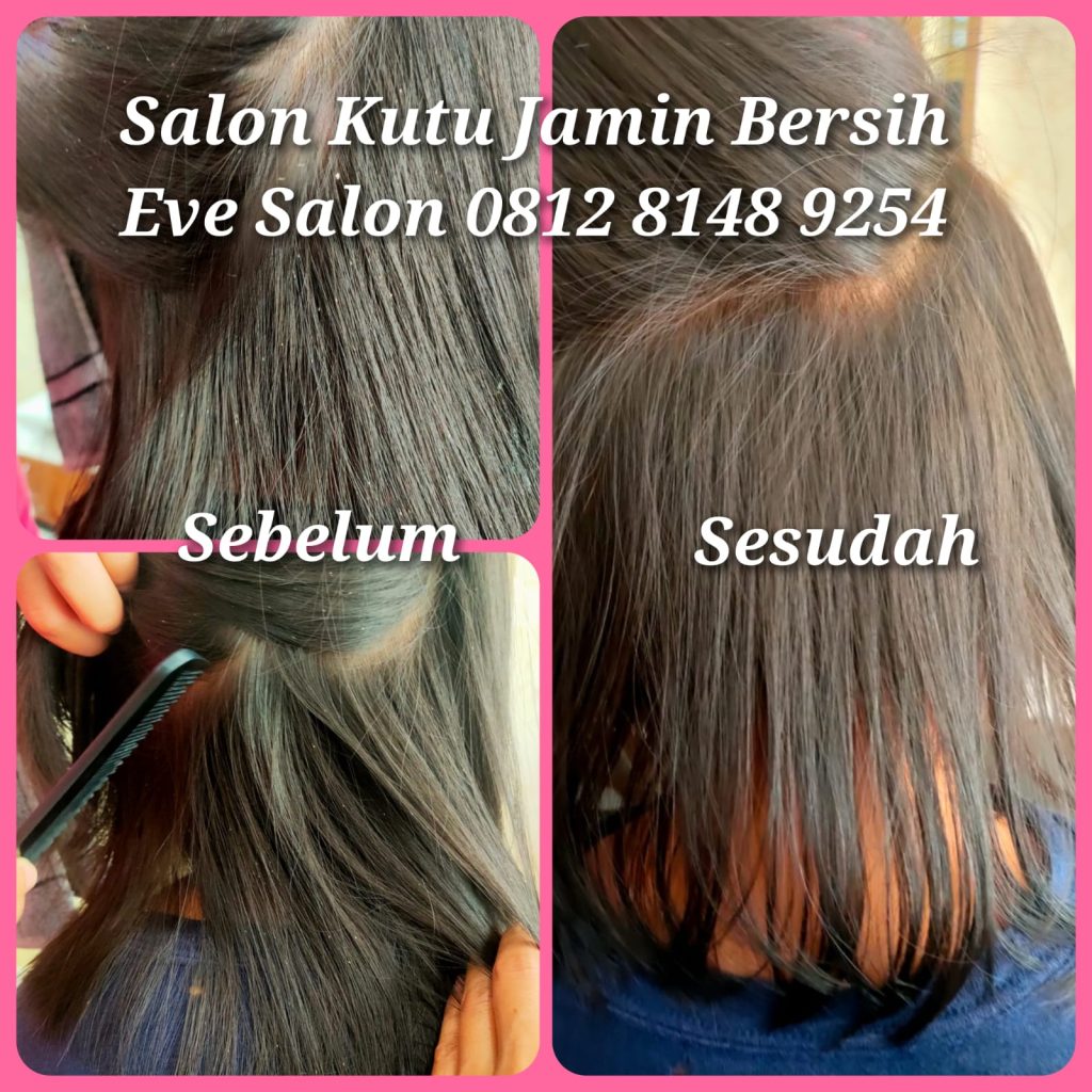 Hasil salon menghilangkan kutu anak di cipayung jakarta timur semua kutu langsung bersih
