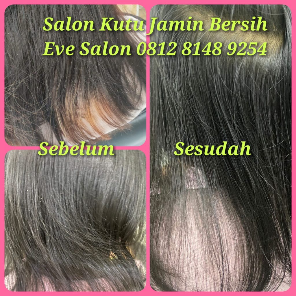 Salon kutu anak cipayung jakarta timur hasil langsung hilang