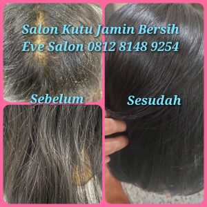 Hasil before after treatment kutu rambut langsung bersih di Eve Salon Ciracas