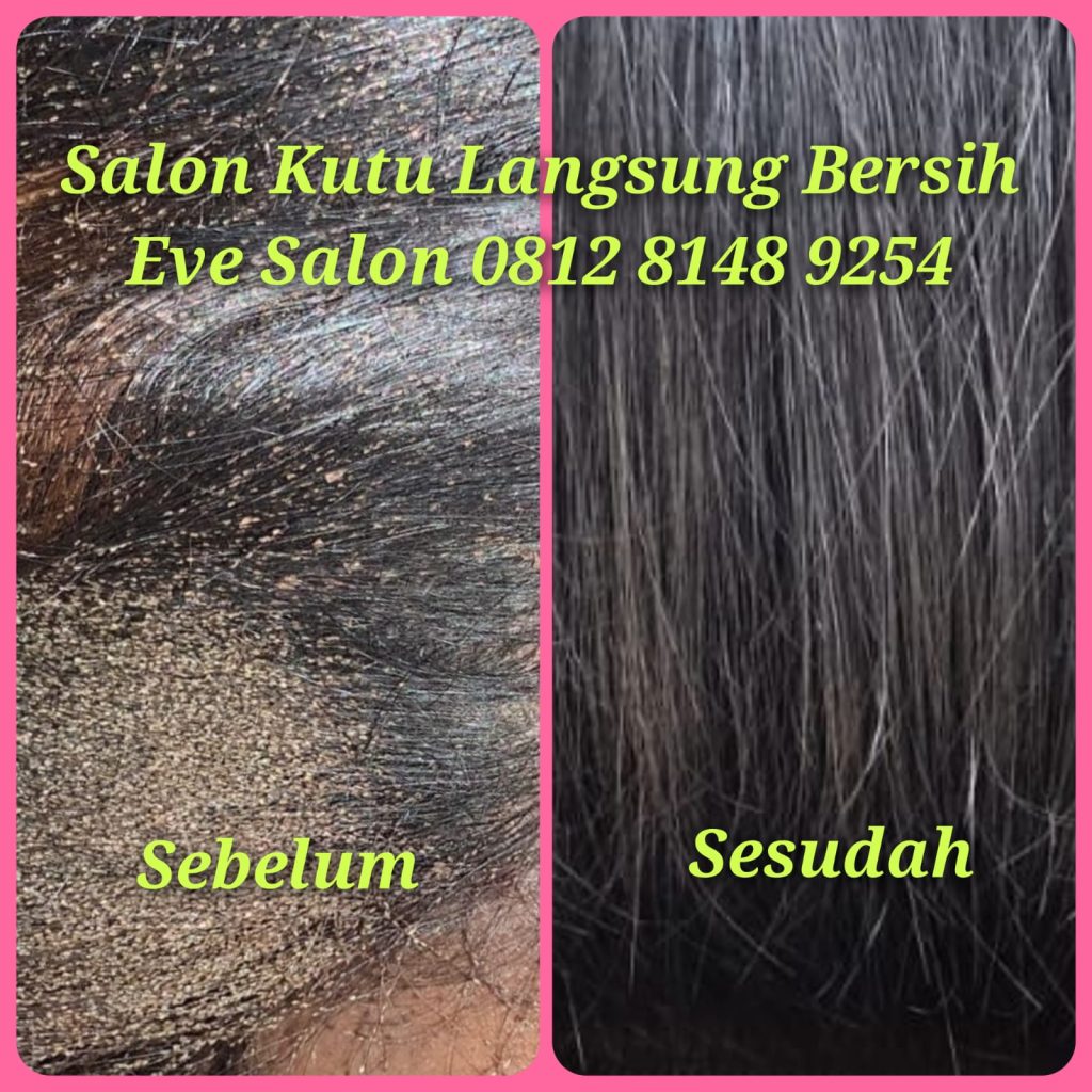 Salon kutu jagakarsa jakarta selatan hasil langsung bersih