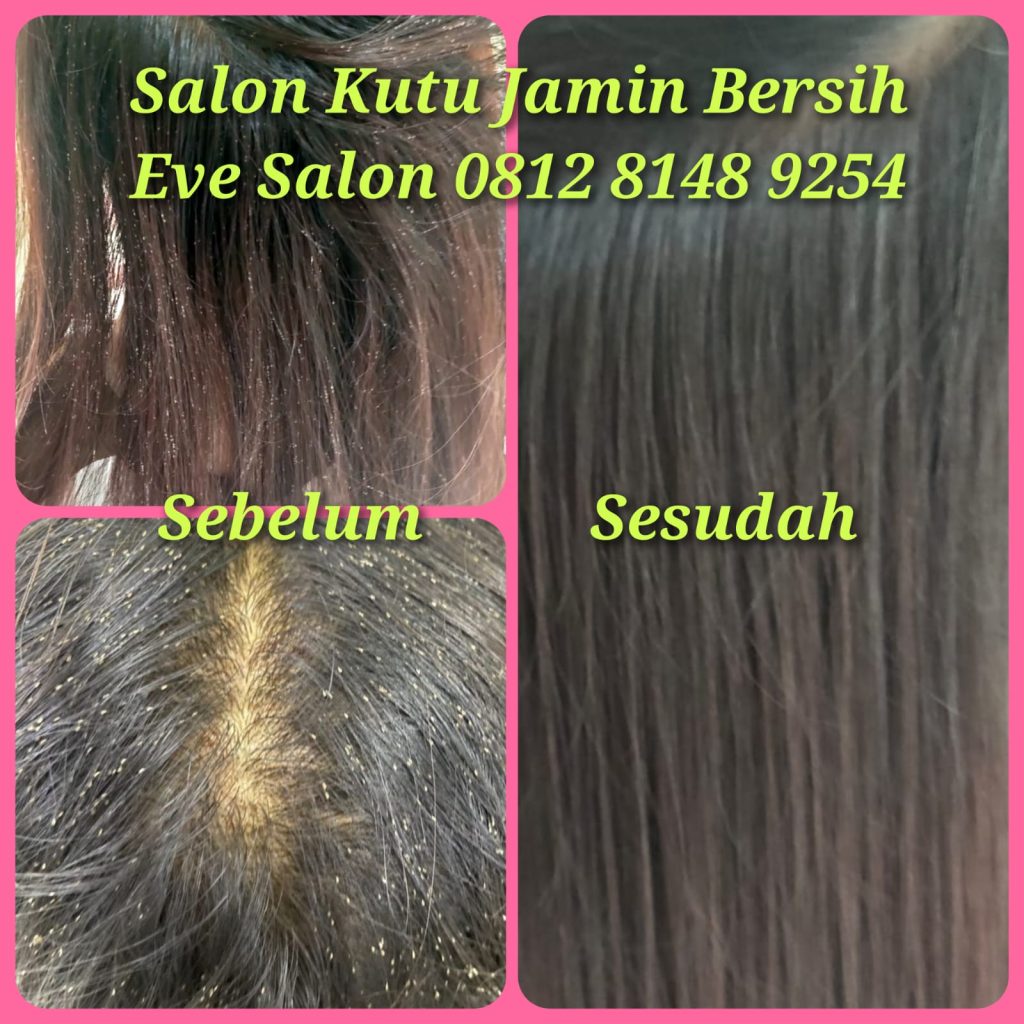 hasil membersihkan kutu rambut langsung bersih