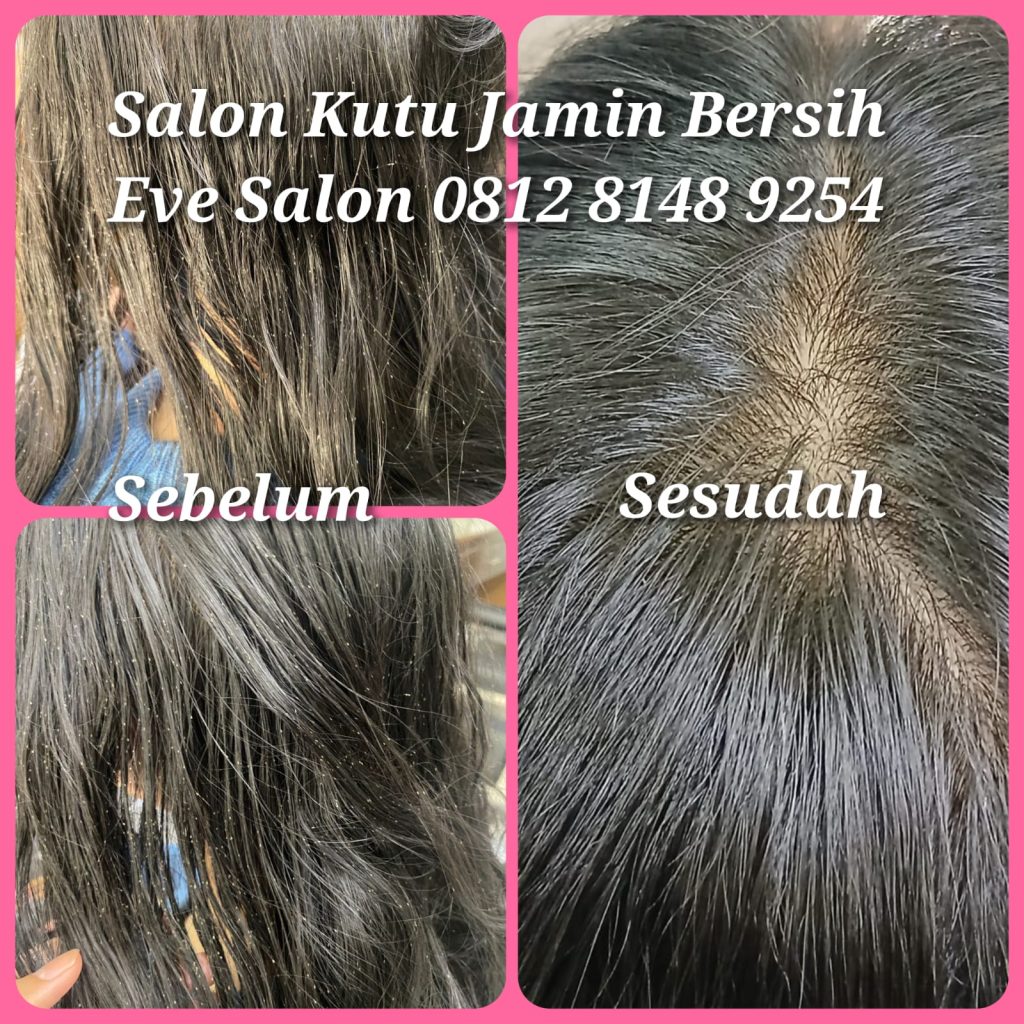 Salon membersihkan kutu di pasar rebo terpercaya langsung bersih total sekali basmi. Induk hingga telor telor kutu benar benar bersih.